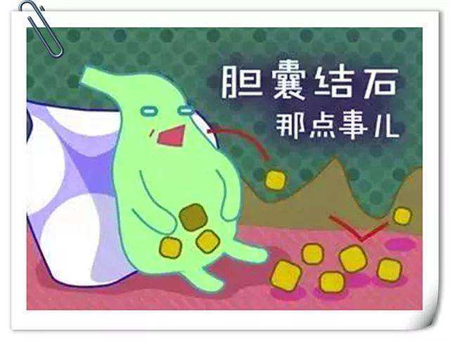 胆源性胰腺炎胆囊切除后饮食注意,胆囊切除胆总管增宽要注意饮食吗