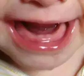 宝宝长牙怎么帮他缓解疼痛,如何缓解长牙期孩子的不舒服