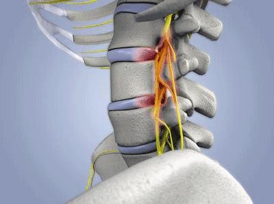 胳膊肘撞到麻筋之后一直麻,撞到胳膊肘突然麻了一下