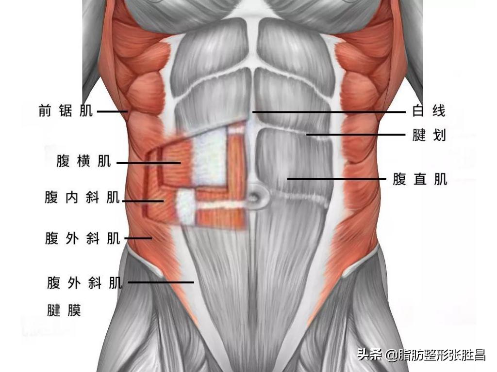 想要马甲线可以练出来吗,腰腹吸脂马甲线恢复过程