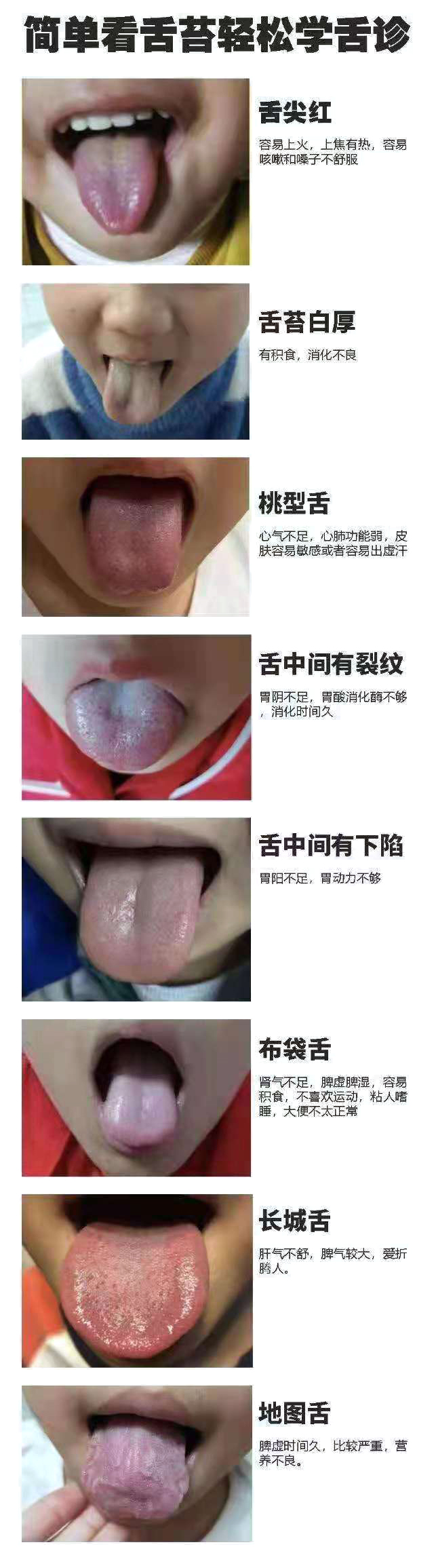 一招教你看舌苔图片,一张图看懂孩子学习