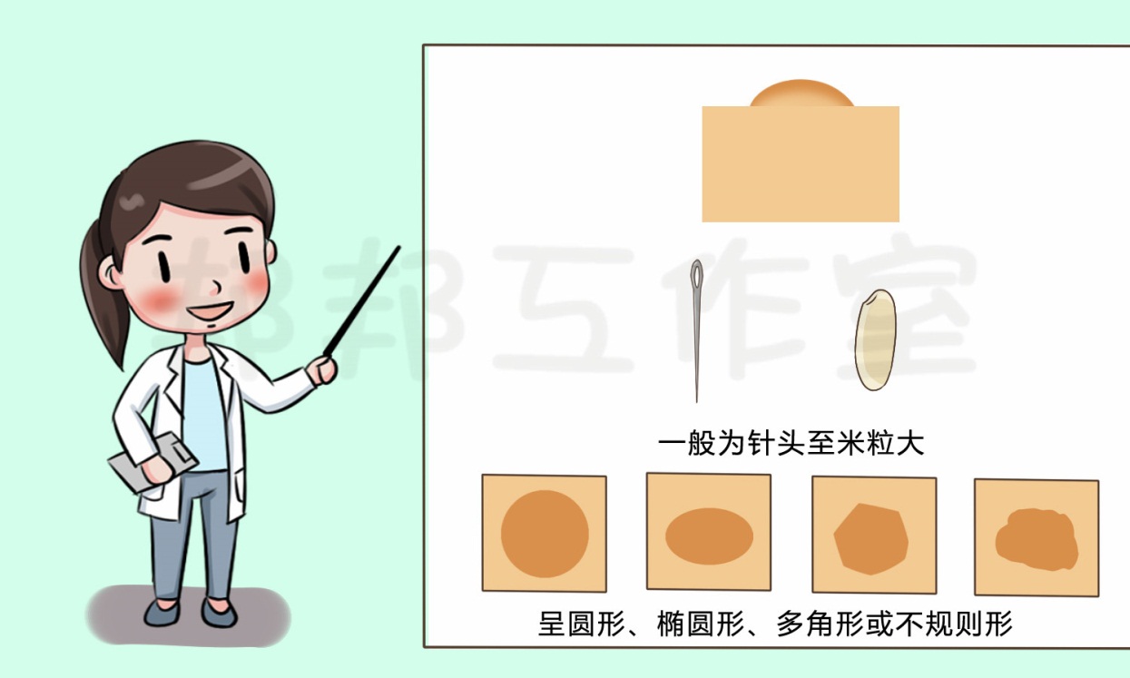 脸上长的瘊子会传染吗,脸上长瘊子用剪刀剪掉就好了