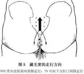 屁屁中间毛太多，也可能是病吗？