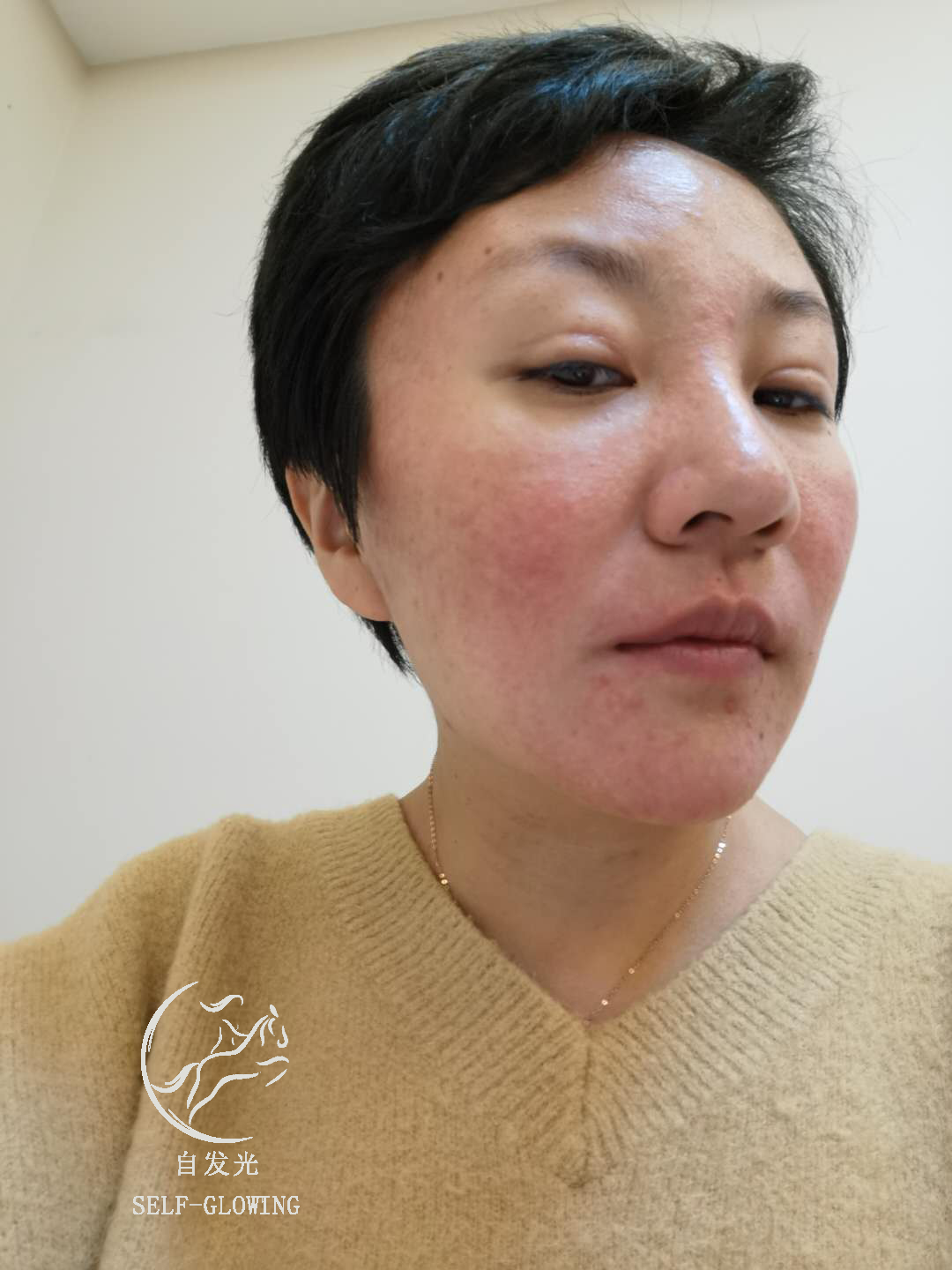 敏感肌修护烂脸推荐,泛红敏感肌修复抗老