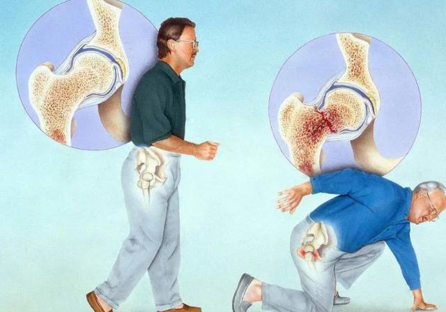 钟南山院士早餐说吃鸡蛋牛奶,钟南山院士的早餐喝什么