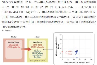 罕见！宫颈癌孕妇阴道分娩，婴儿吸入癌细胞导致肺癌