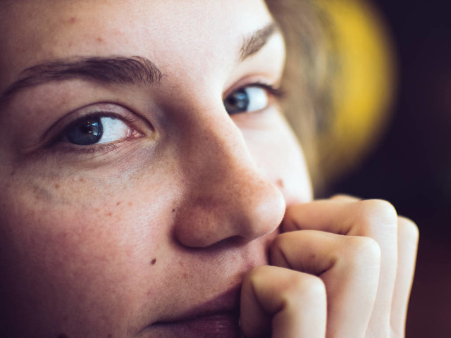 脸上有雀斑怎么消除雀斑,雀斑很常见但要如何祛除才正确