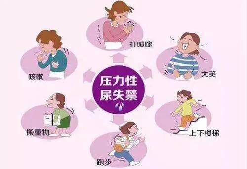 生完孩子尴尬事项,生娃时的尴尬事