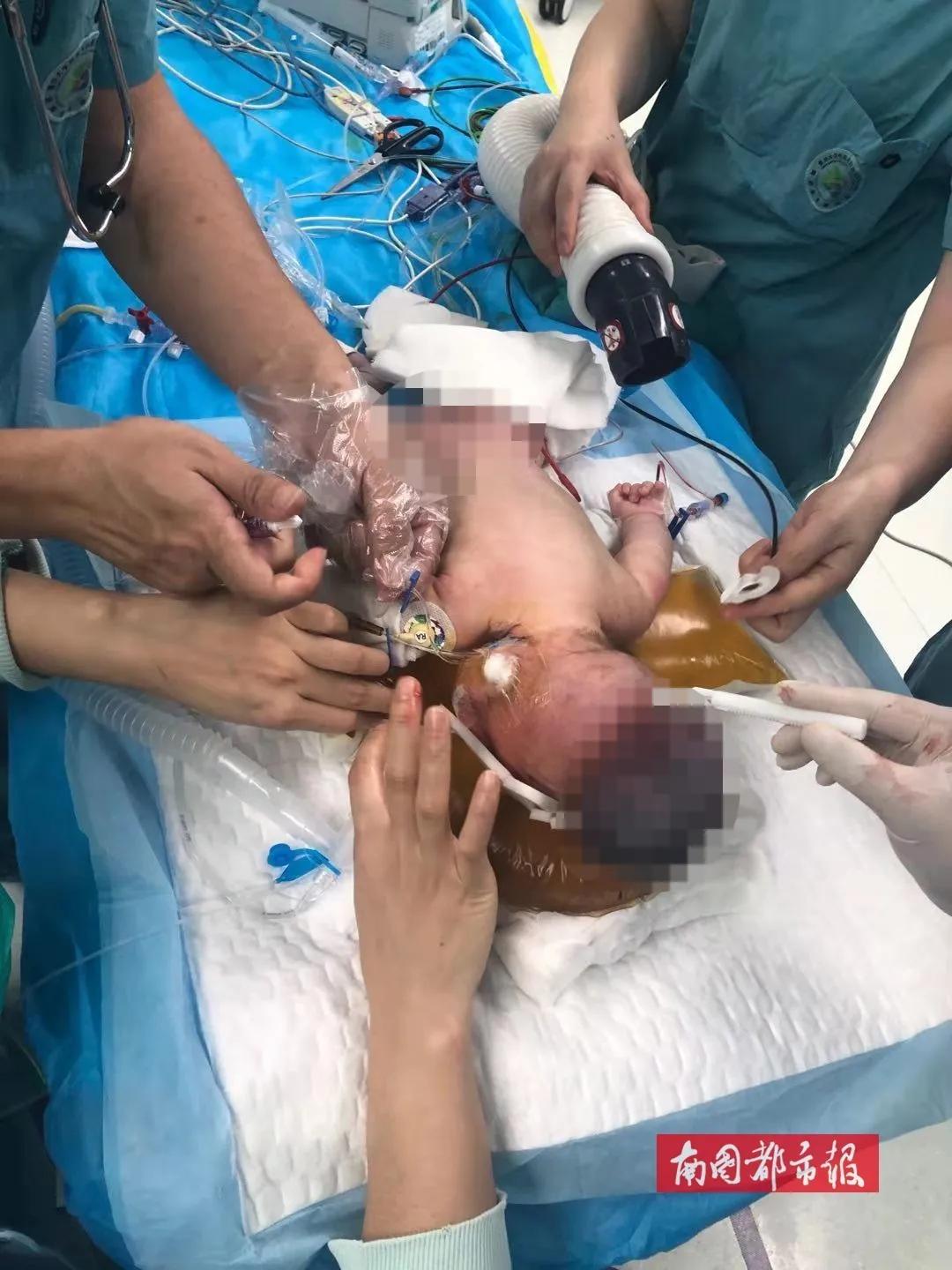 心疼妈妈生产的宝宝,心疼生孩子的妈妈