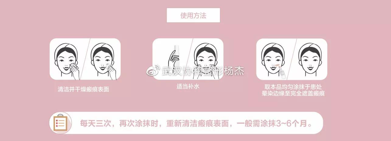 疤痕体质可以做全切双眼皮吗,疤痕体质可以做埋线双眼皮吗