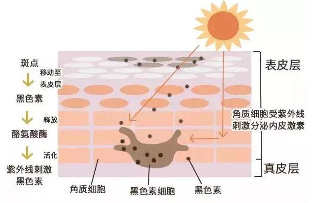 黑眼圈显憔悴教你5种方法来消除,黑眼圈很重气色很差怎么改善