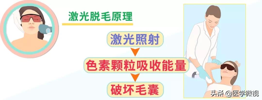 猕猴桃女孩腋下脱毛,猕猴桃女孩轻松脱毛的救星