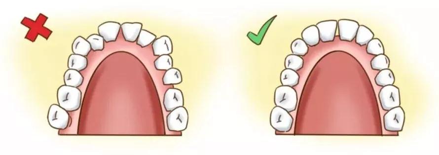 矫正牙齿可以改变小下颌吗,矫正牙齿可以改变脸型