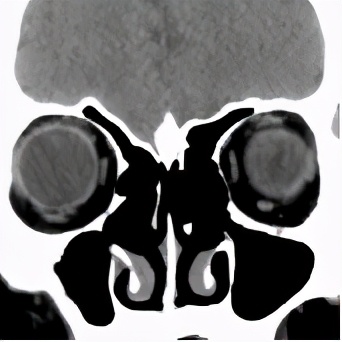 头痛眼睛胀痛流鼻涕全身无力,鼻子痛引起头痛眼睛疼是什么原因