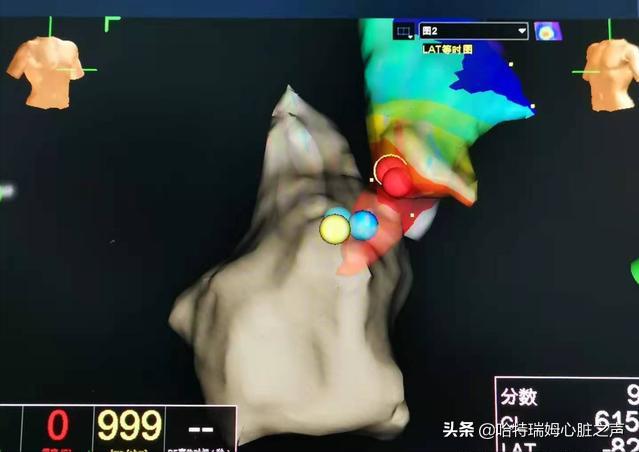 施海峰心内科,施海峰北大医院