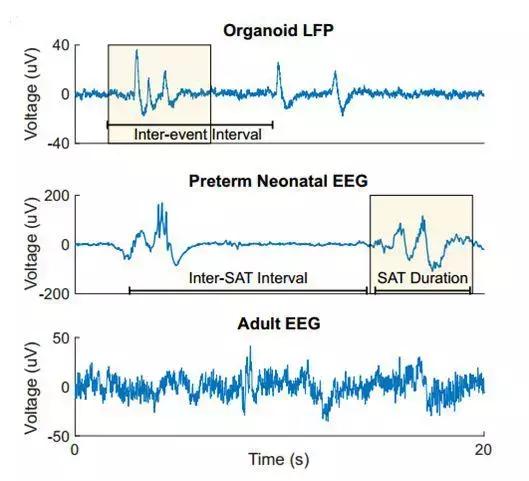 人工培养类婴儿“大脑”,或可用于治疗疾病