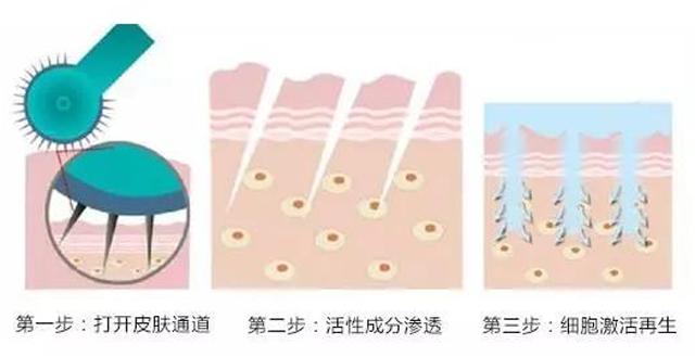 血丝多怎么办,血丝红是怎么回事