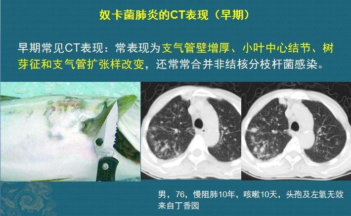 这个细菌提醒你，别买病死的鱼，它是个吃草的细菌，后来学会吃鱼