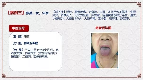肿瘤与糖尿病的区别,糖尿病与癌症之间回顾性分析