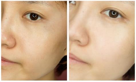 虾青素真的可以抗氧化吗,虾青素抗氧成功