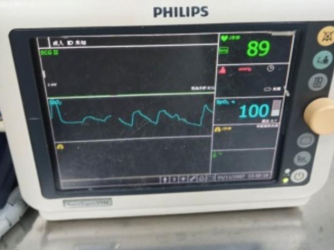 妇产医生扭转胎位,中医胎位倒转术