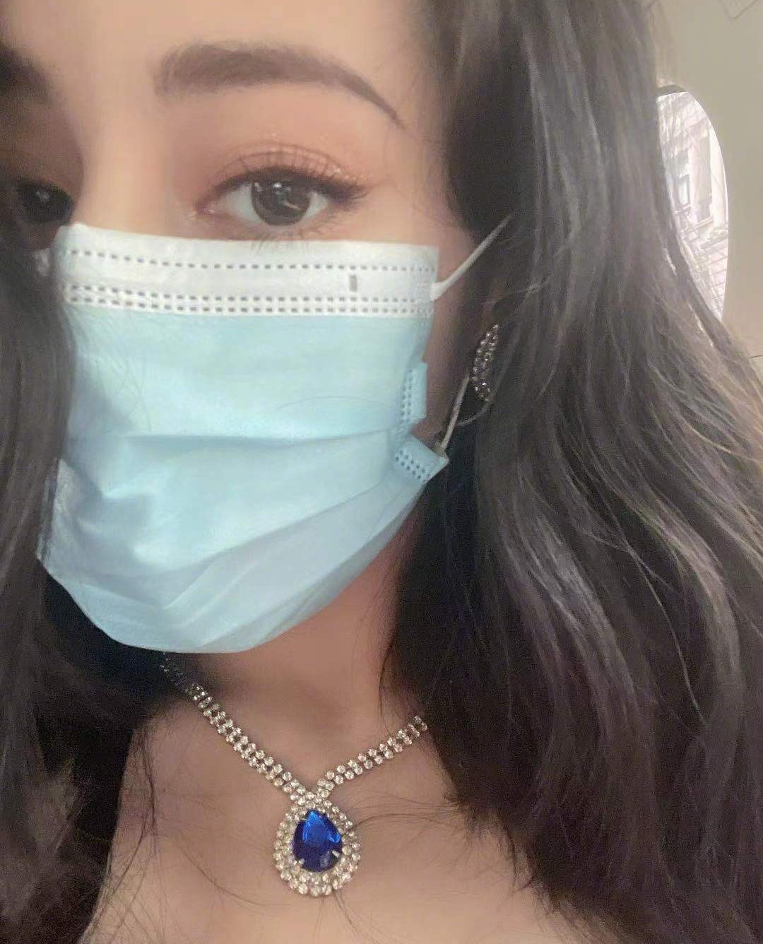 麦粒肿赵丽颖,赵丽颖angelababy宋雨琦