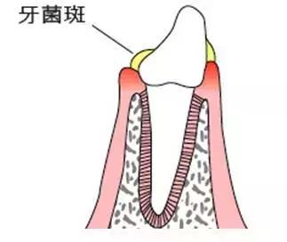 一口黄牙竟让形象尽毁！‘到手香’帮你重新找回自信！大胆开笑