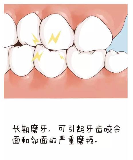 如何日常护理牙齿,平时怎样做好牙齿的保护