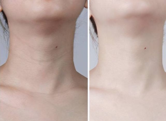 输在包装上的这3款老牌护肤品，虽卖不了高价，但个个都有真本事