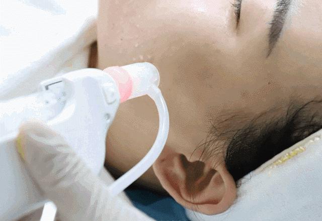 第一次做医美选择什么项目,第一次做医美项目如何选择