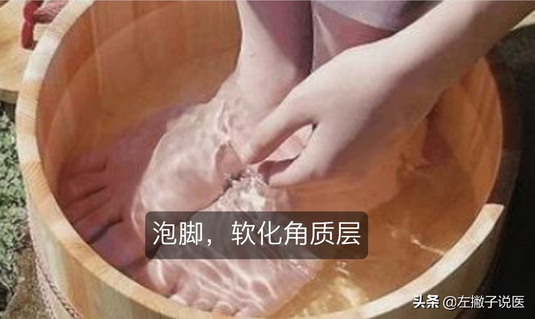 老年人冬天脚后跟开裂怎么办,脚后跟开裂冬天最快的恢复方法