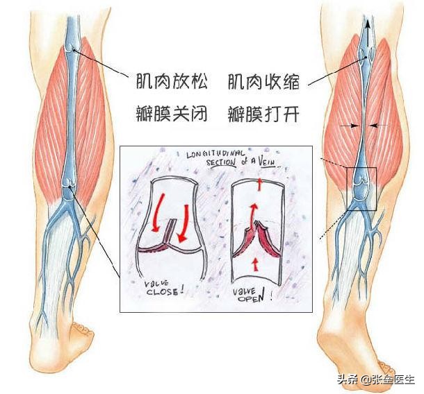 经常站立导致小腿静脉曲张,大腿上有小蚯蚓是不是静脉曲张