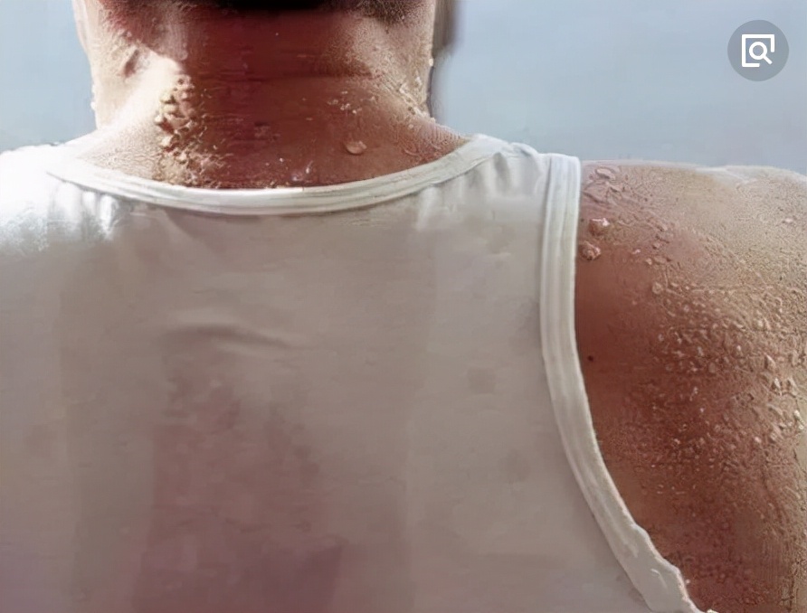 汗蒸出汗过多会有什么反应,汗蒸出汗多好还是不好呢