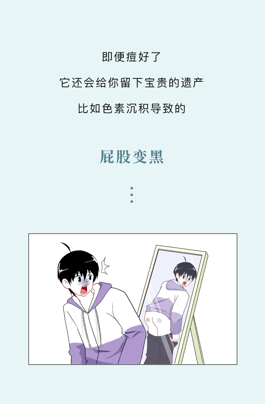 夏天出汗内裤老贴屁股上怎么办,夏天屁股老是出汗粘裤子