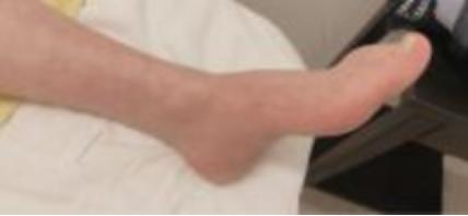 古派针灸,黄贵生针灸视频全集