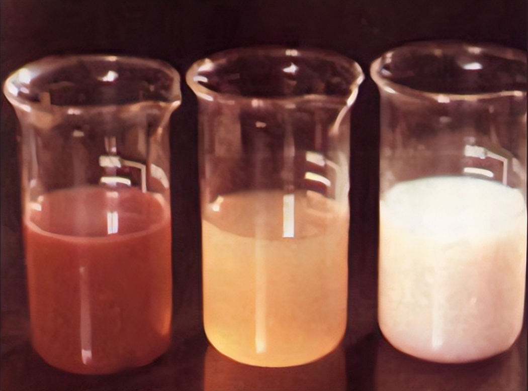 乳糜尿的病因、诊断与治疗