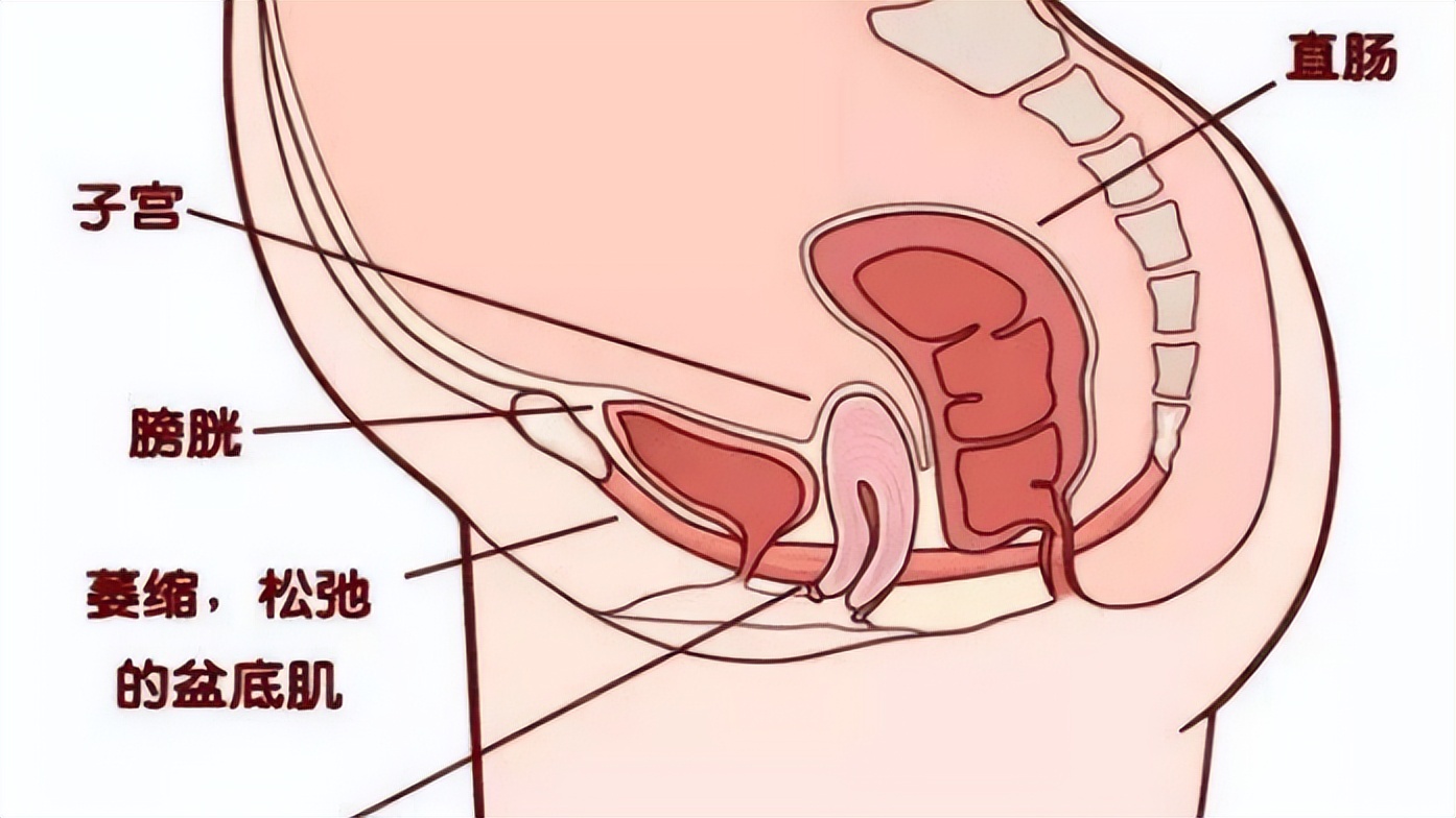 女人一咳嗽就漏尿是什么原因,打喷嚏和咳嗽漏尿怎么回事