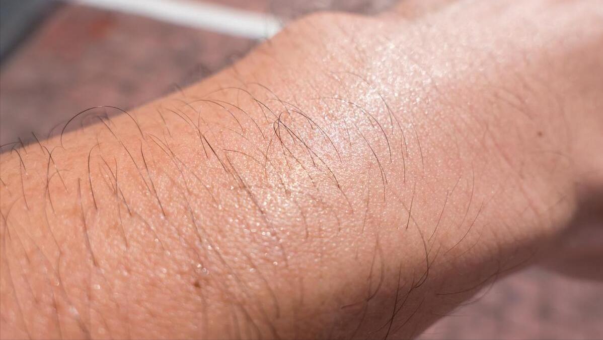 女性屁股中间为啥也会长毛？能不能直接剃掉？医生劝你手下留情