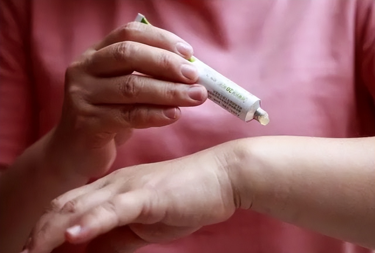 红霉素软膏可以去除老年斑吗,治疗脸上老年斑涂抹什么药膏