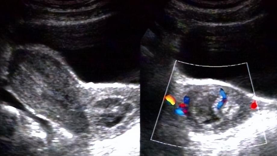 我女儿17岁月经有一年多没来了,女儿今年13岁了没来过月经