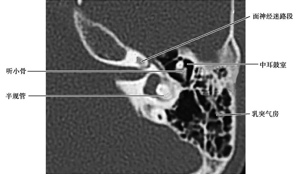 耳部解剖结构和生理功能,耳部解剖笔记