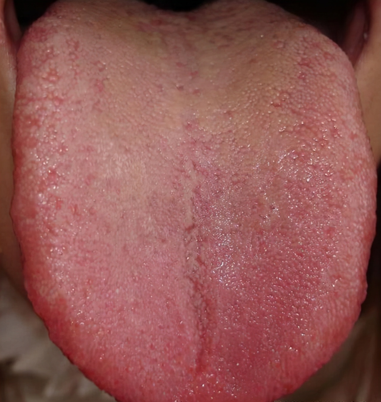 中医认为糖尿病的最好治疗方法,中医治疗糖尿病有几种治疗方案