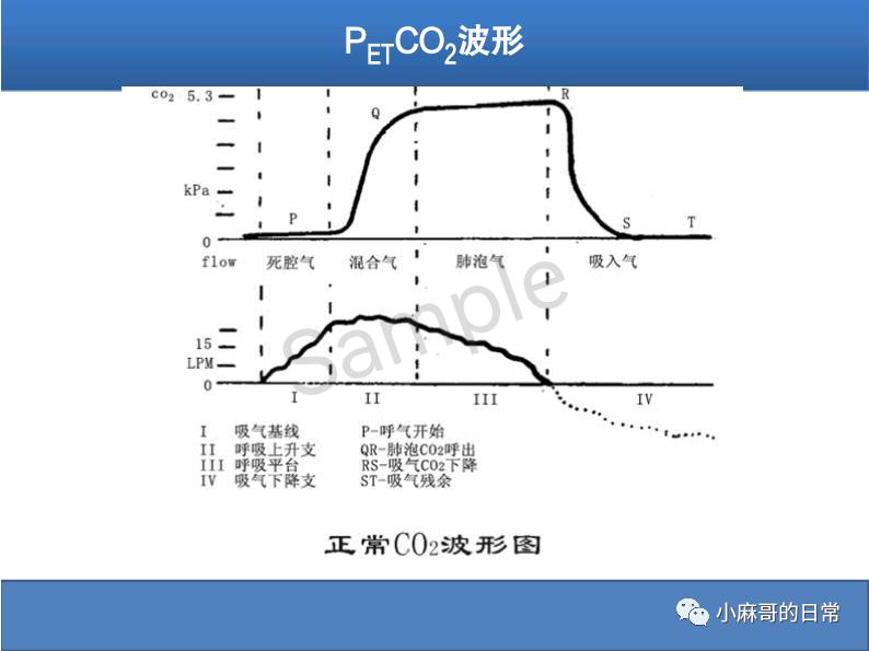 呼气末二氧化碳检测图的解读,呼气末二氧化碳检测操作视频