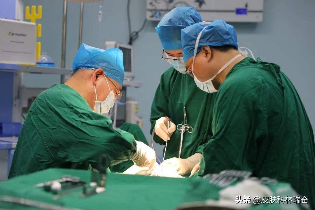 让凹陷性疤痕长平的家庭小妙招,上海治疗凹陷性疤痕哪个医院好