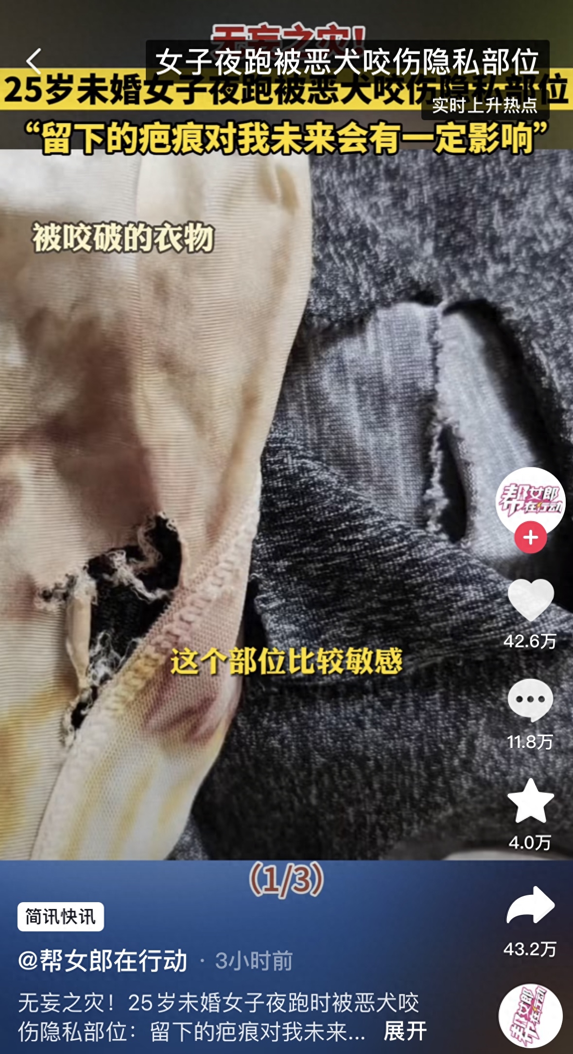 25岁女教师跑步途中遭狗袭击，隐私部位受伤，狗主人拒绝赔偿