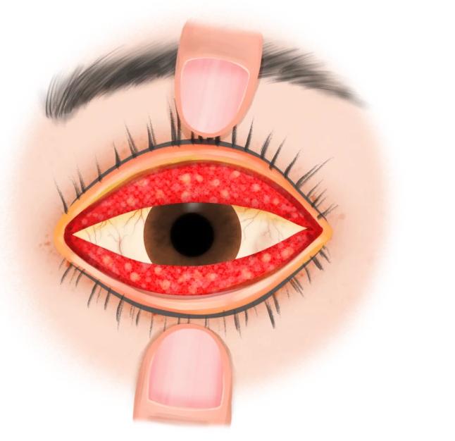 逍遥丸是好但这四类人不能用,逍遥丸可以缓解更年期的症状吗