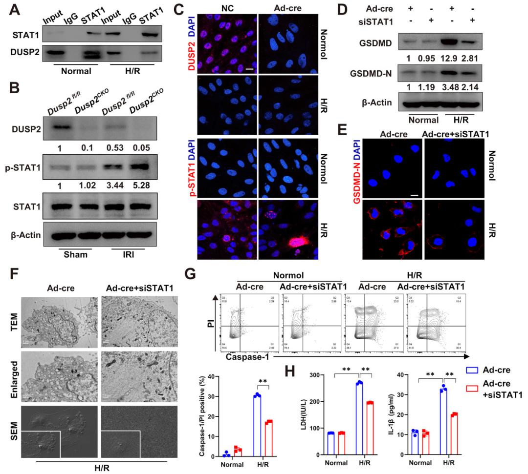 Theranostics|急性肾损伤治疗策略