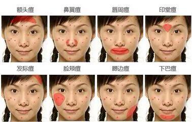 皮肤痘痘粉刺,各种皮肤痘痘问题讲解