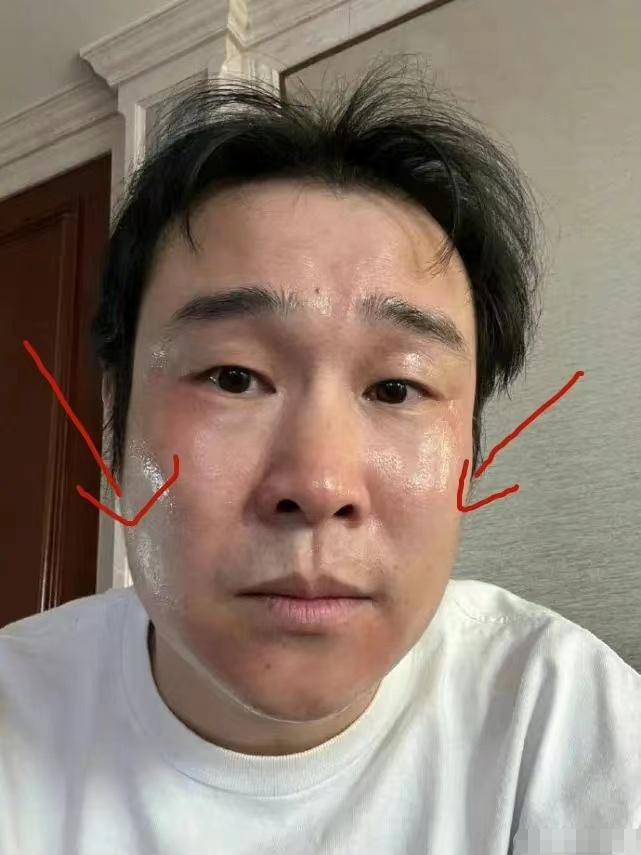 确诊阳性的明星,被确诊为阳性的明星