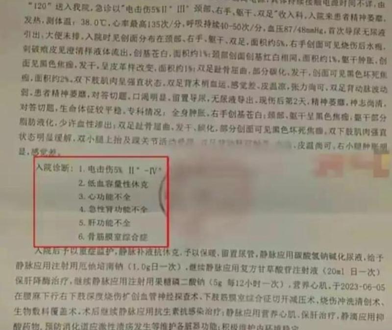 女孩iphone充电被电击面临截肢,iphone边充边玩被电击